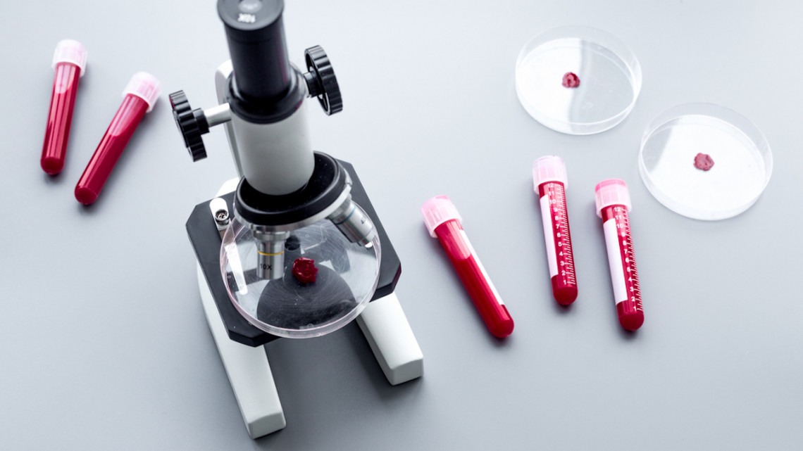 Ellenőriztesd egészségi állapotodat komplex véranalízissel és 3 alkalom lézerterápiával