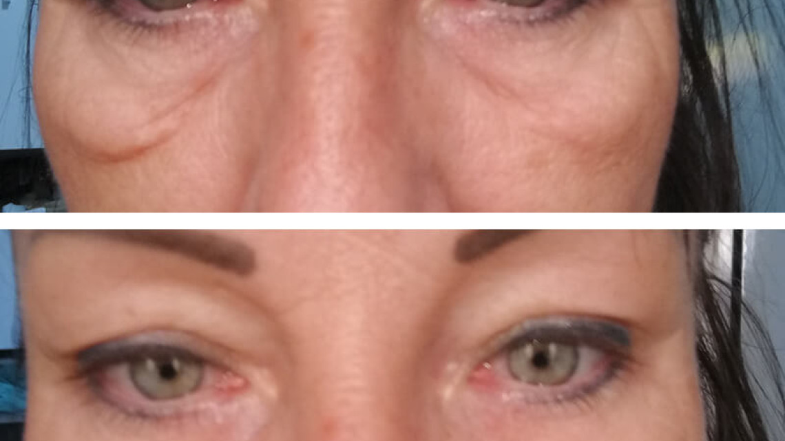 InstanTENSE Plus emelő hatású szérum (25 ml)