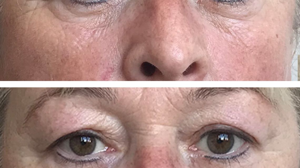 InstanTENSE Plus emelő hatású szérum (25 ml)