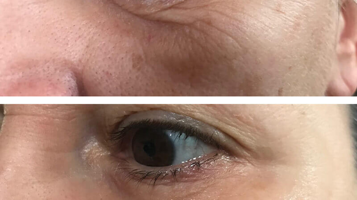 InstanTENSE Plus emelő hatású szérum (25 ml)